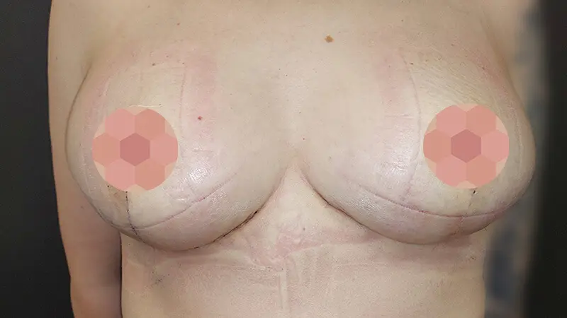 Redukcja 0008 10 po blur