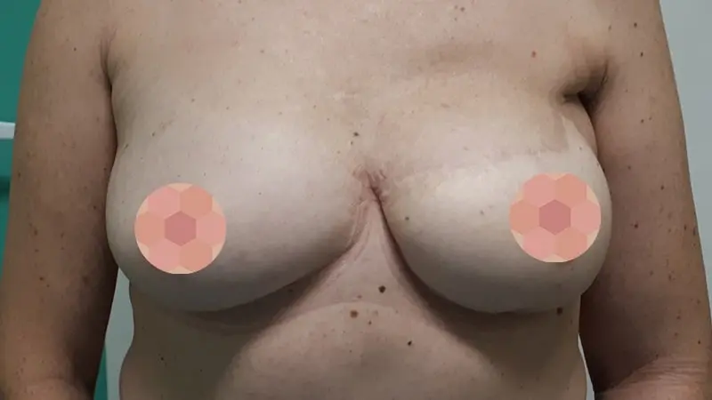 Rekonstrukcja gierej 0011 DIEP 3 po